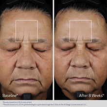 Load image into Gallery viewer, Elastiderm Advanced Filler Concentrate