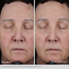 Load image into Gallery viewer, ELASTIDERM® LIFT UP & SCULPT FACIAL MOISTURIZER
