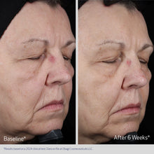 Load image into Gallery viewer, ELASTIDERM® LIFT UP & SCULPT FACIAL MOISTURIZER