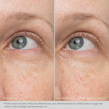 Load image into Gallery viewer, Obagi Daily Hydro-Drops Rejuvenating Eye Gel Cream