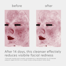 Load image into Gallery viewer, EltaMD Skin Recovery Amino Acid Foaming Cleanser