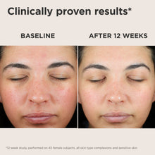 Load image into Gallery viewer, EltaMD UV Skin Recovery Red Color Correcting Green Tint SPF 50
