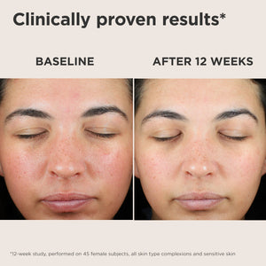 EltaMD UV Skin Recovery Red Color Correcting Green Tint SPF 50