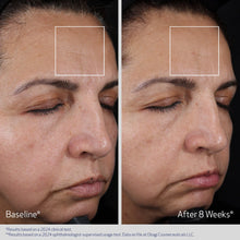 Load image into Gallery viewer, Elastiderm Advanced Filler Concentrate
