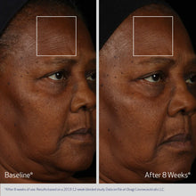 Load image into Gallery viewer, Obagi Elastiderm Facial Serum
