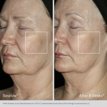 Load image into Gallery viewer, Obagi Elastiderm Facial Serum
