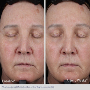 ELASTIDERM® LIFT UP & SCULPT FACIAL MOISTURIZER