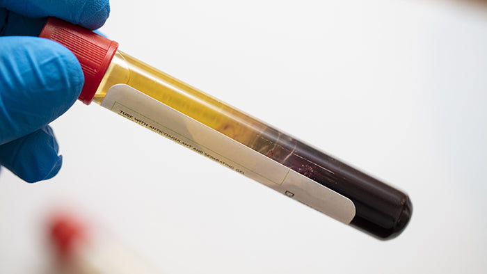 PROGEN PRP - Platelet-Rich-Plasma